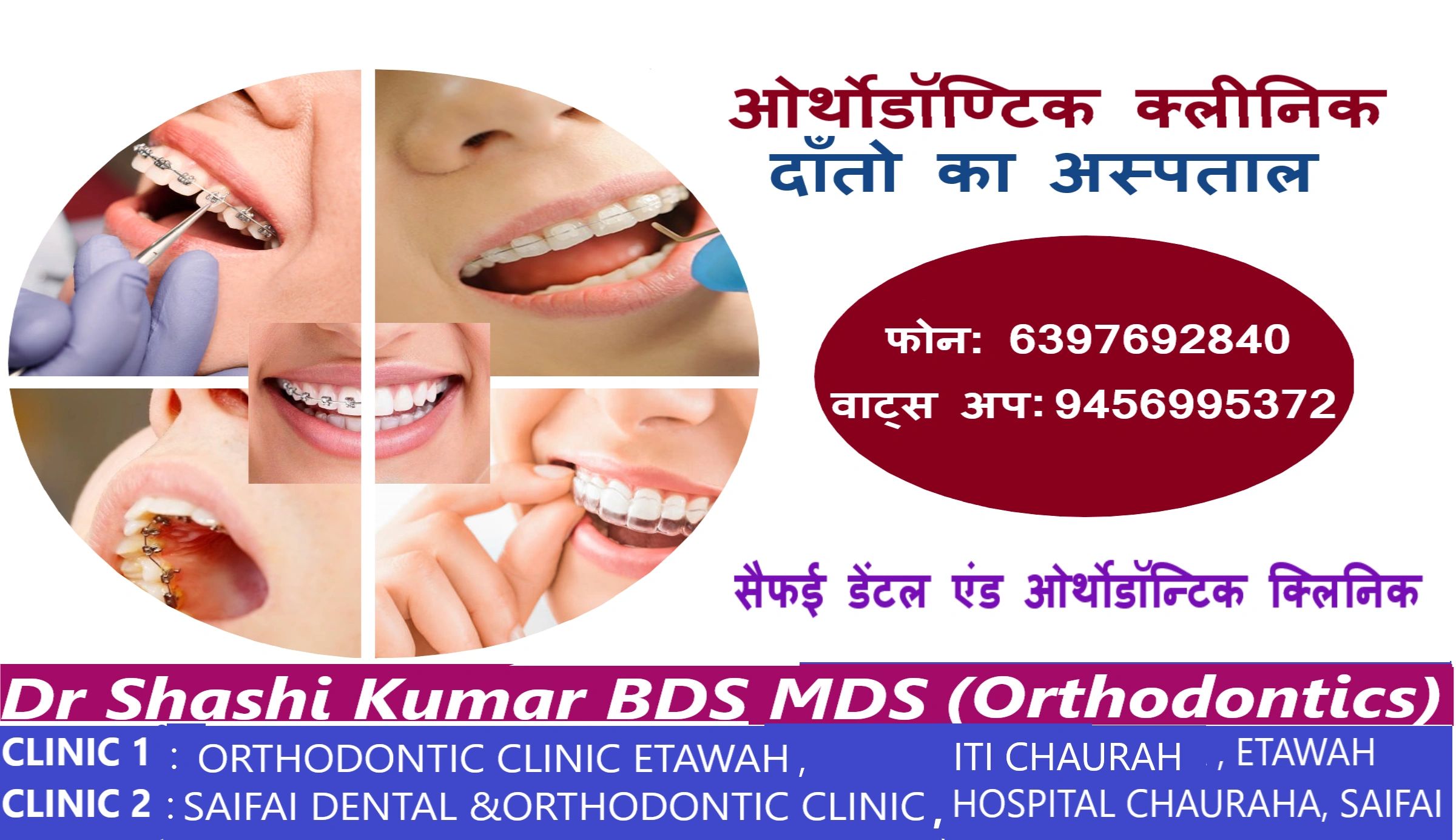 orthodontic-clinic-etawah-home